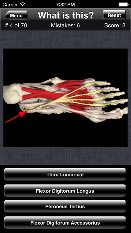 Anatomy Foot Quiz screenshot-3