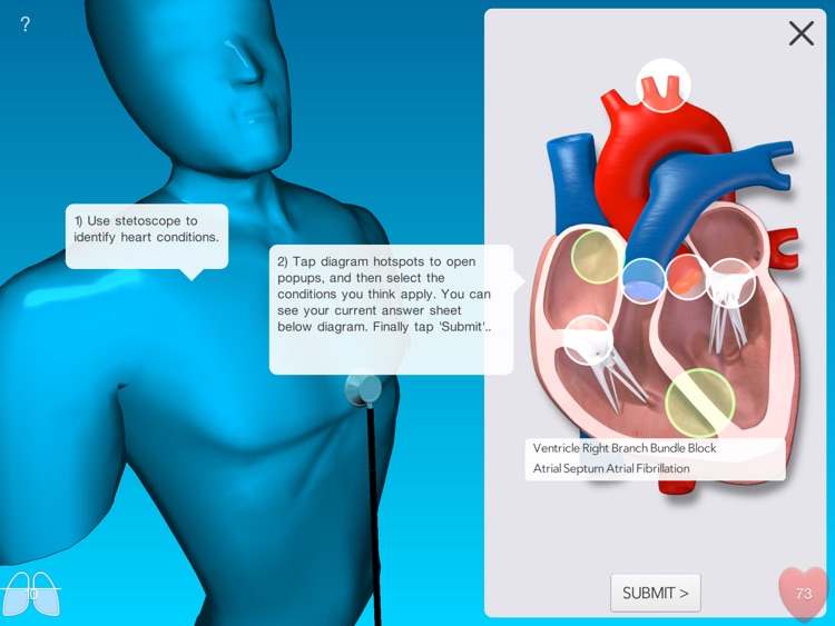 heartALP screenshot-4