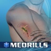 Medrills: Bite and Sting Emergencies