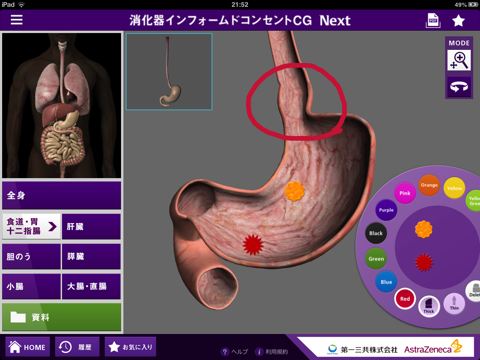 消化器インフォームドコンセント CG Nextのおすすめ画像2