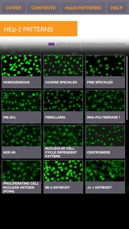 ZEUS IFA Digital ANA HEp-2 Cell Pattern Identification Guide