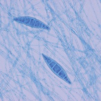 Microbiology and Immunology Lippincotts Illustrated QA Review