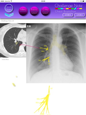 Challenge Note Lung CT screenshot 4