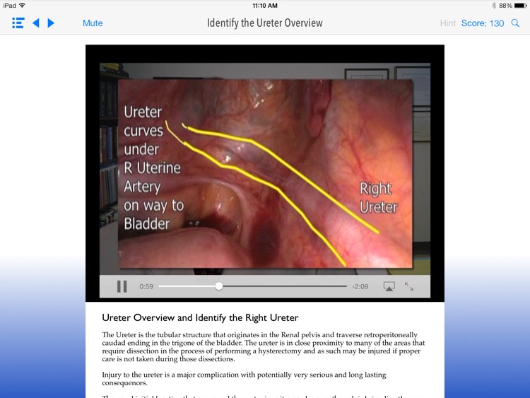 SimPraxis Lap Hysterectomy Trainer