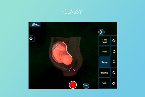 VR Fetus in the Uterus screenshot 4