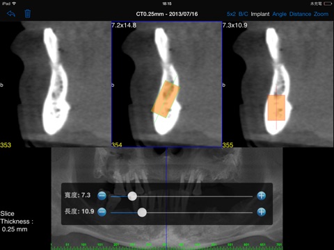 DentalCT screenshot 3