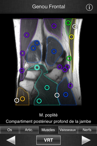 Monster Anatomy - Lower Limb screenshot 4