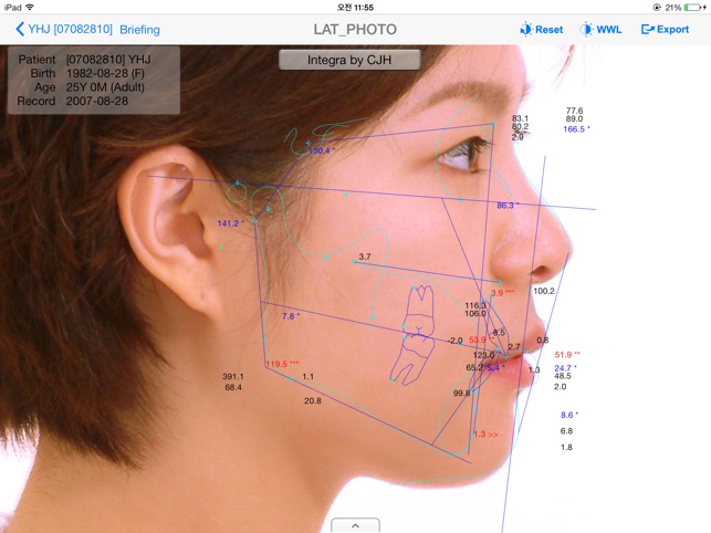 Smart V-Ceph(圖2)-速報App