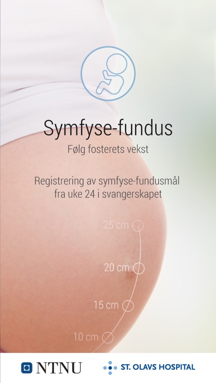Symfyse-fundusmål for gravide