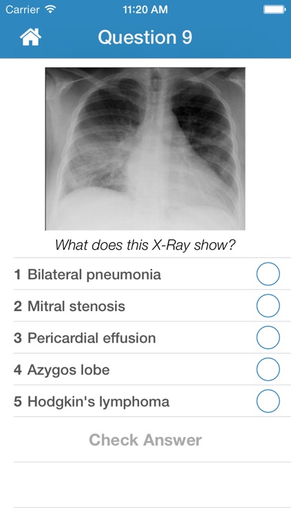 Chest X-Ray Training