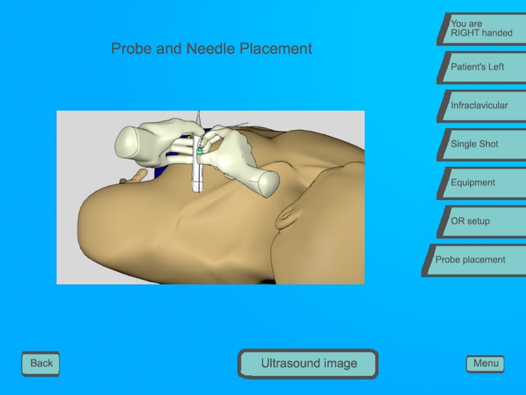Regional Anesthesia Assistant for iPad screenshot-3