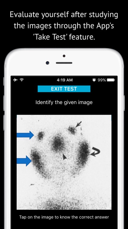 Radiology Imaging for Students screenshot-4