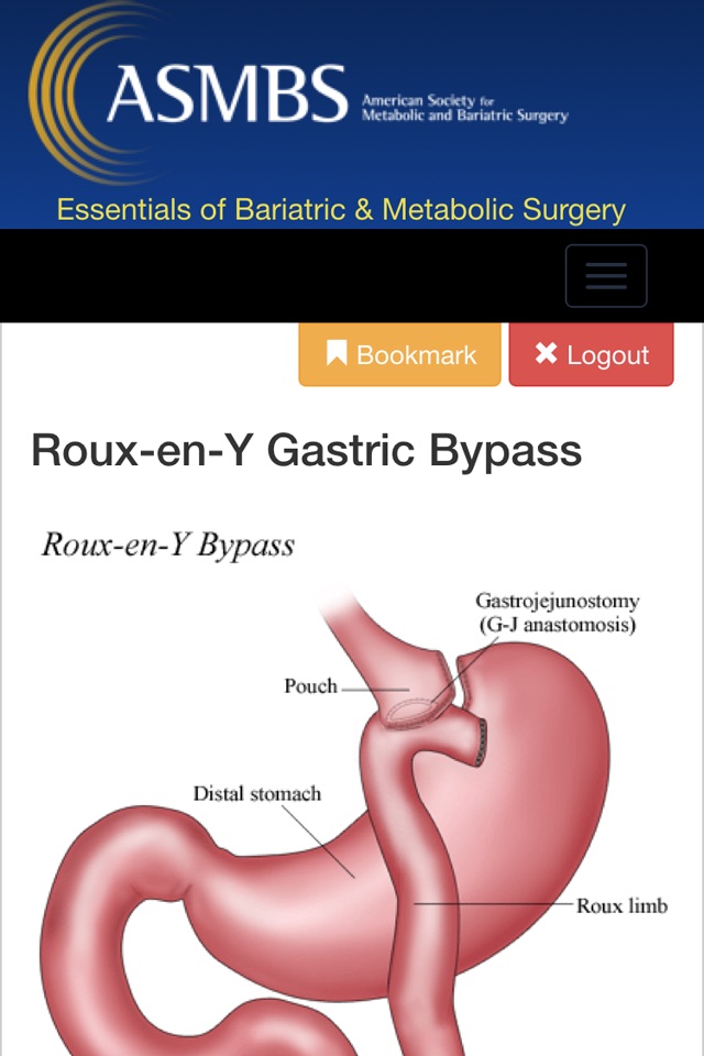Essentials of Bariatric & Metabolic Surgery screenshot 4