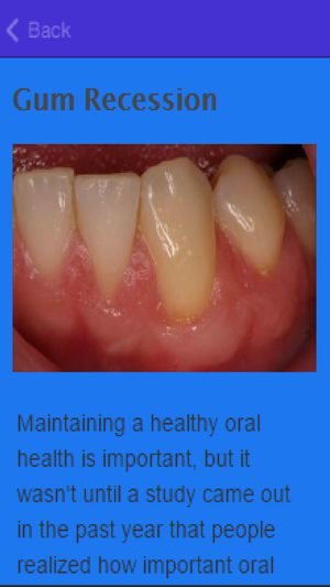 How To Stop Receding Gums(圖3)-速報App