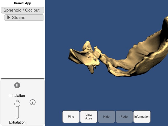 3D Osteopathic Cranial(圖2)-速報App