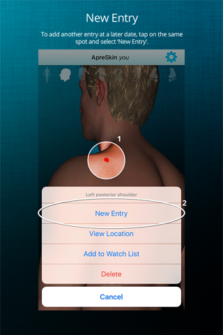 ApreSkin you - track your moles, skin cancers / melanoma and blemishes screenshot 3