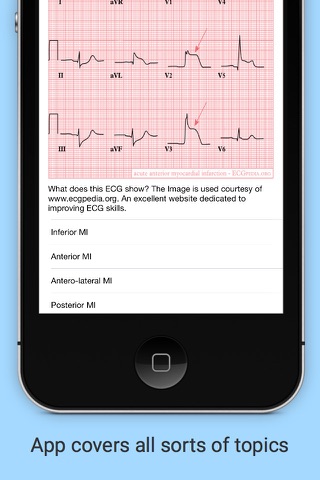 iMCQs in General Medicine screenshot 3