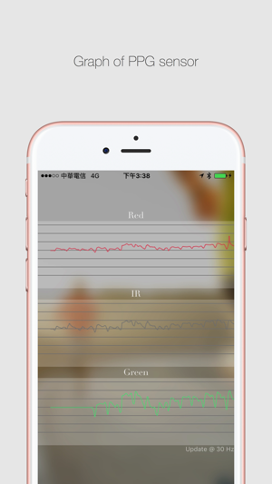 MtM MtConnect04 Pulse Oximeter(圖3)-速報App