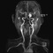 This application provides a quick and easy reference to calculate the required volume of Gadolinium based contrast agents for MRI scan