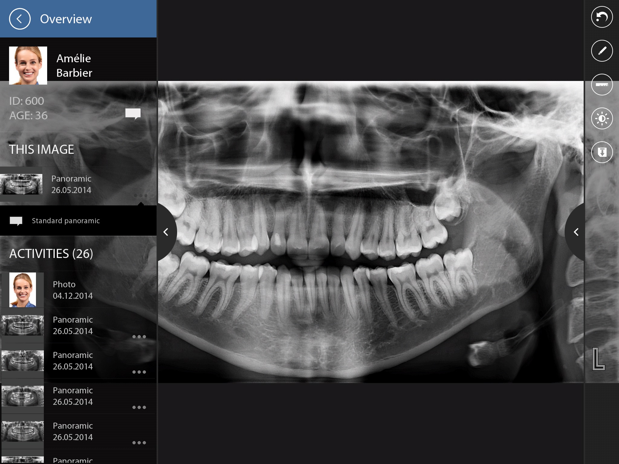 Planmeca mRomexis screenshot 3