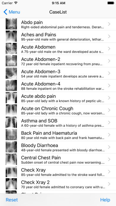 Xrays4Medics Screenshot 2