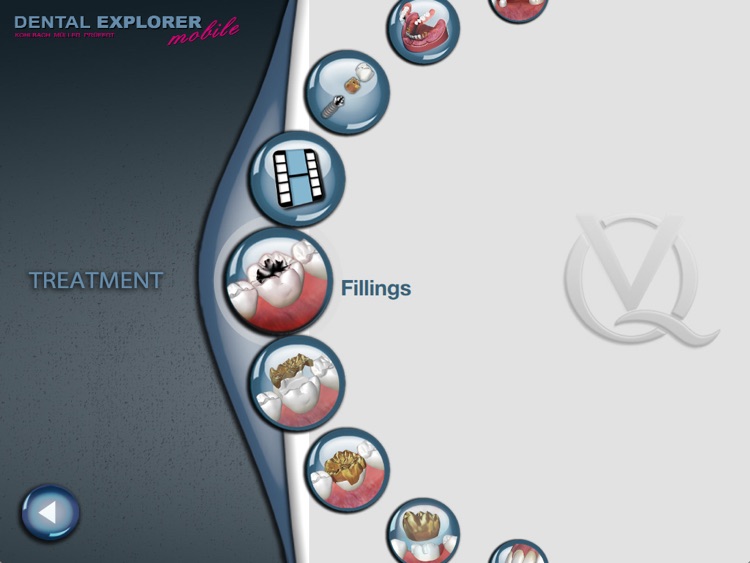 DENTAL EXPLORER mobile