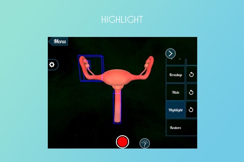 VR Female Reproductive System screenshot 3
