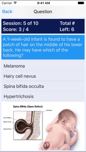 NP Neonatal Review