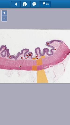 Smart Histology(圖3)-速報App