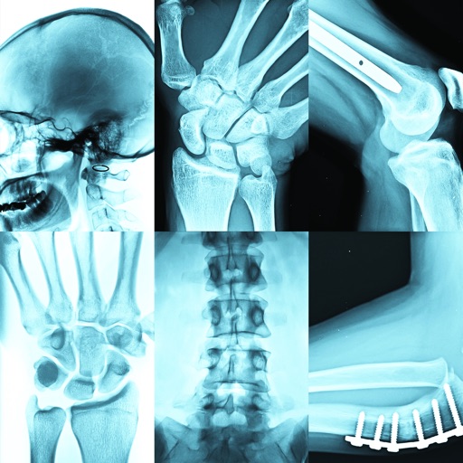 RSM Trauma