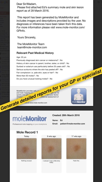 moleMonitor - Skin Cancer Mole Checker screenshot-4