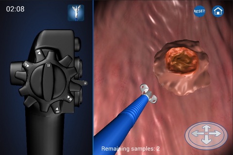 Endoscopy 3D screenshot 4