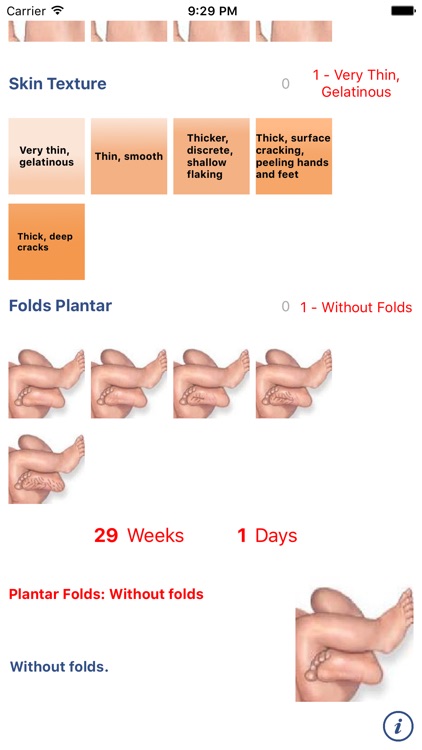 Neonatology: Test Capurro