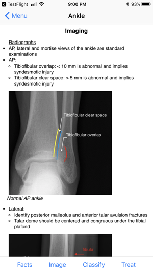 Ortho Traumapedia(圖4)-速報App