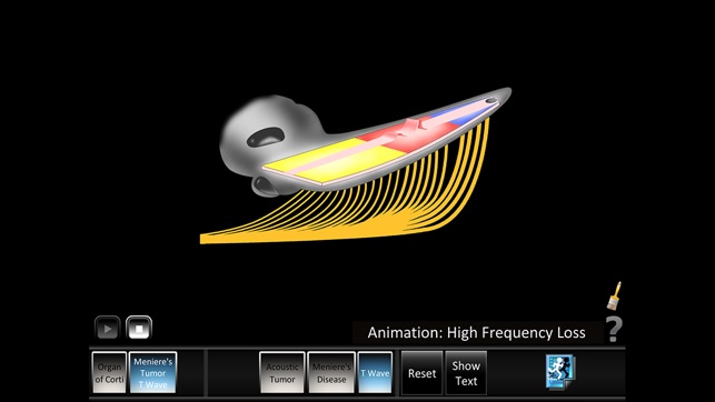 Ear Disorders: Inner(圖3)-速報App