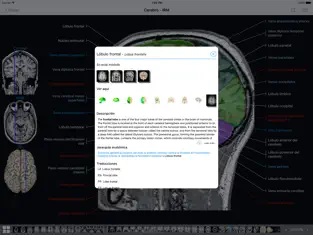 Image 3 IMAIOS e-Anatomy iphone