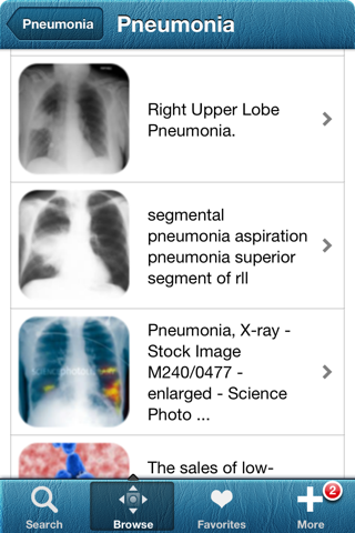 1000 Allergy,Asthma Dictionary screenshot 2