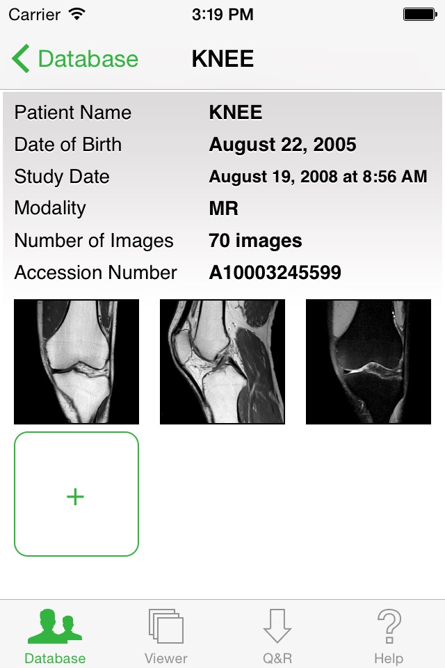 OsiriX HD screenshot 3