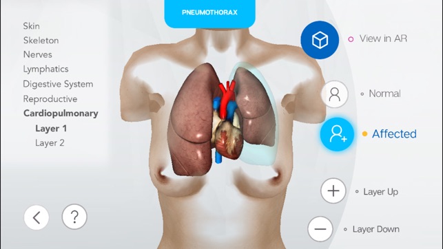 Chest Emergencies(圖3)-速報App