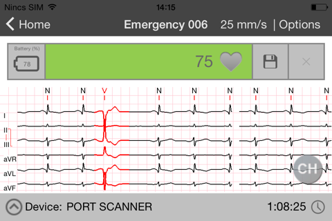 Cardiospy Mobile ECG screenshot 4