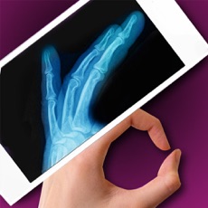 Activities of Simulator X-Ray - Finger Prank