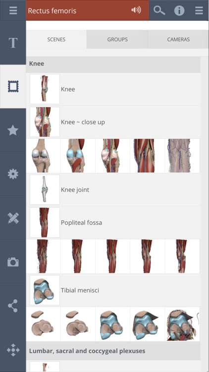 Knee: 3D Real-time