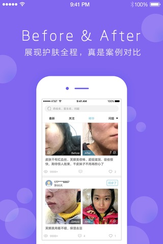 皮肤宝-测肤祛痘护肤案例分享平台 screenshot 4