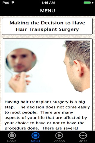 Best Hair Transplant Pre-Procedure, Preparation and Process Guide & Tips Made Easy for Beginners screenshot 2