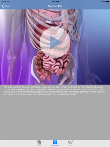 Human Physiology: Body Structures and Fucntions Free screenshot 3