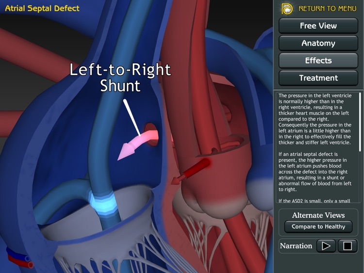 3D Road Map to ASD & VSD