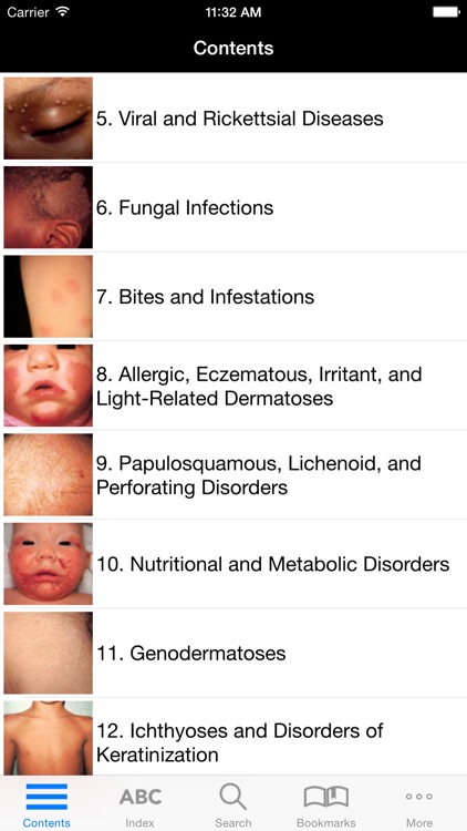 Color Atlas of Pediatric Dermatology