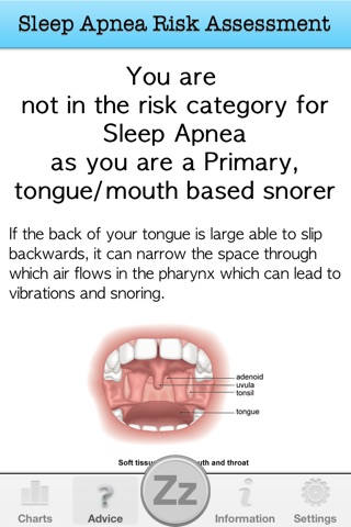 Snore Loop - Track Your Snoring And Sleep Apnea screenshot 4