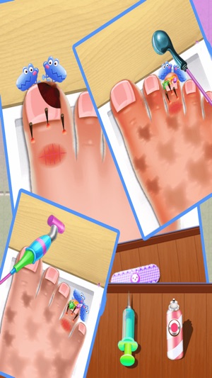 Nail doctor : Kids games toe surgery doctor games(圖2)-速報App