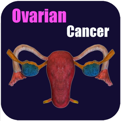 Ovarian Cancer V1